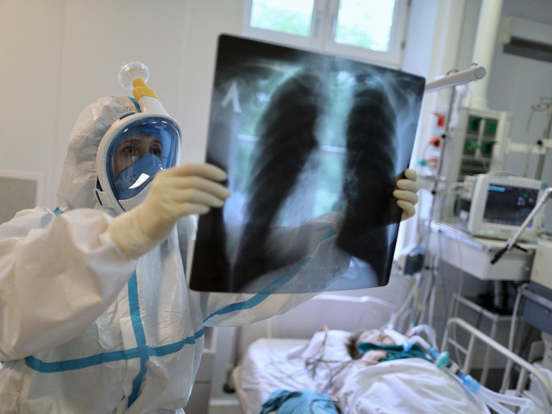 В России 9035 новых случаев коронавируса, 162 человека умерли
